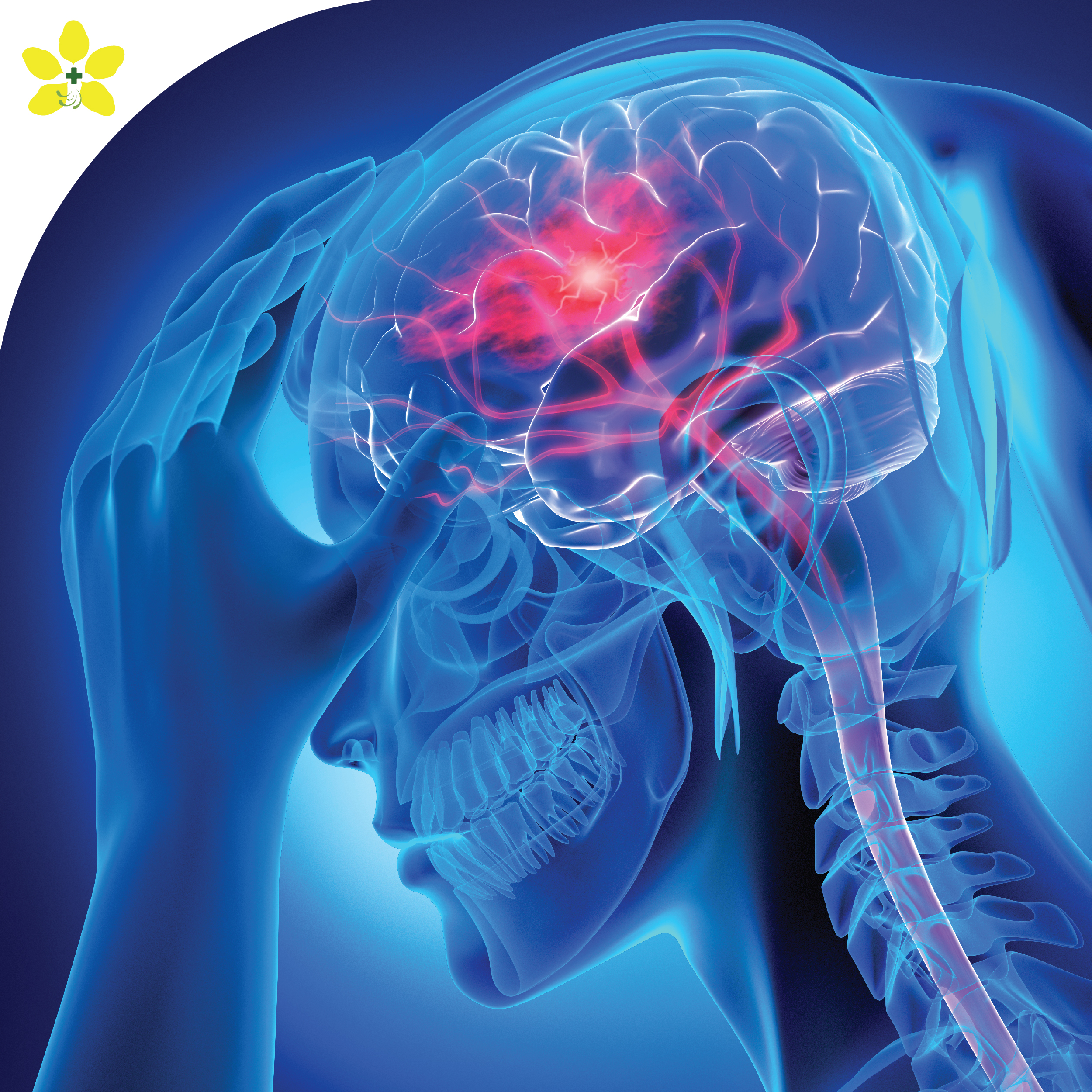 Stroke Screening Program